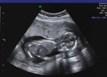 Subhanallah, Inilah Mukjizat Alquran tentang Jenis Kelamin Bayi