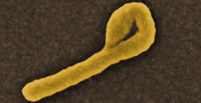 http://www.globalresearch.ca/wp-content/uploads/2014/10/ebola-virus1-400x206.jpg