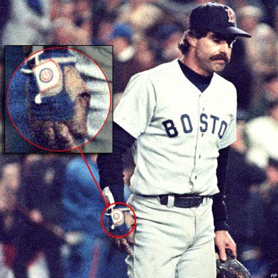  Sox were saddled with not one 