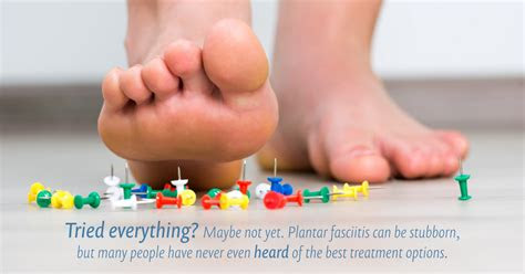 Plantar fasciitis occurs when the band of tissue in the arch of the foot becomes irritated causing heel pain. What Works for Plantar Fasciitis? What Doesnât? Why?