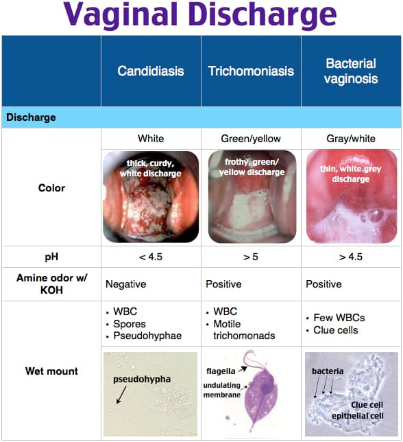 Bv white discharge