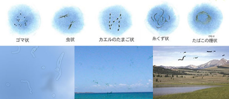 気を付けたい眼の疾患と症状