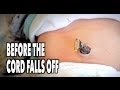 How Soon After Umbilical Cord Falls Off Can Baby Bathe : The Diehl Family: Griffin's 1st Bath at Home! / Until the umbilical cord falls off, it is best to give your baby sponge baths.