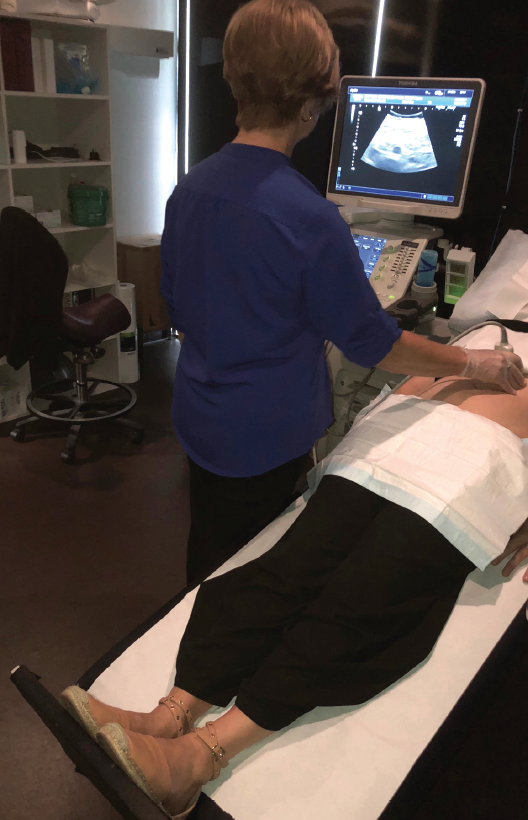 Our Protocol For Transabdominal Pelvic Vein Duplex Ultrasound Endovascular Today