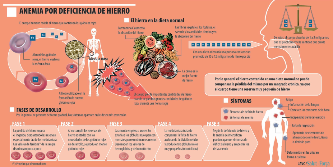 Anemia, la enfermedad cuando la sangre no es demasiado ...