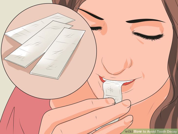 Avoid Tooth Decay Step 17.jpg