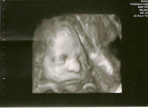 baby @ 29w-3