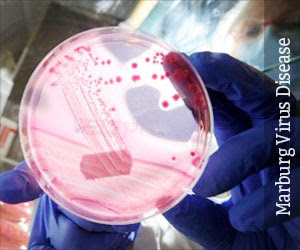 Marburg Virus Disease - Causes, Symptoms, Diagnosis ...
