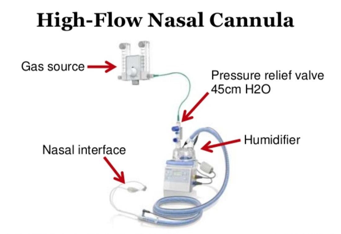heated high flow oxygen therapy