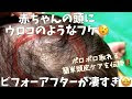 [最も好ましい] 赤ちゃん 頭 皮膚 うろこ 344648-赤ちゃん 頭 皮膚 うろこ