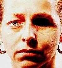 La violencia policial de los Mossos, a examen