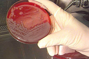 Shown is an anthrax culture. The disease anthr...