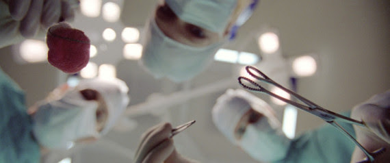 BREAST IMPLANT SURGERY