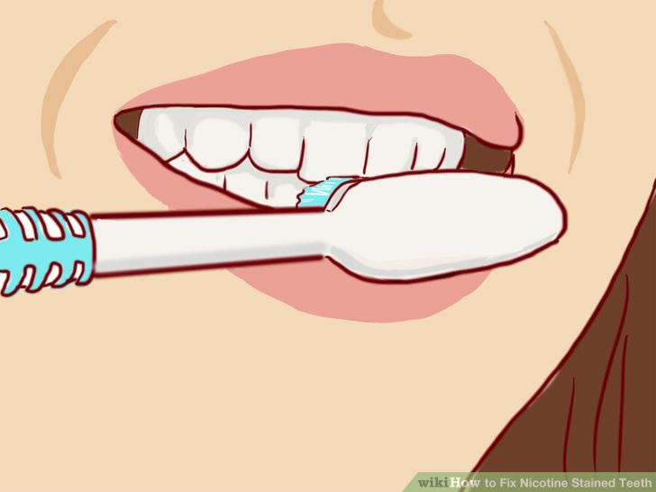 Fix Nicotine Stained Teeth Step 13.jpg
