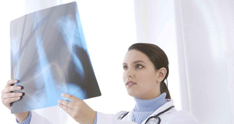 x ray near me brampton
