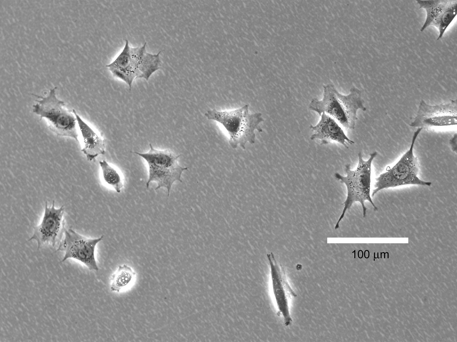 Cultured fibroblasts