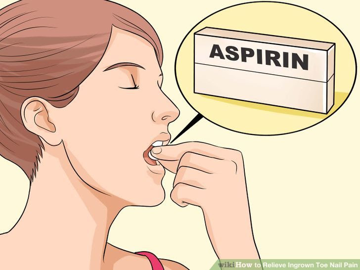 Relieve Ingrown Toe Nail Pain Step 9 Version 3.jpg