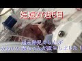 妊娠27週 出産 132255
