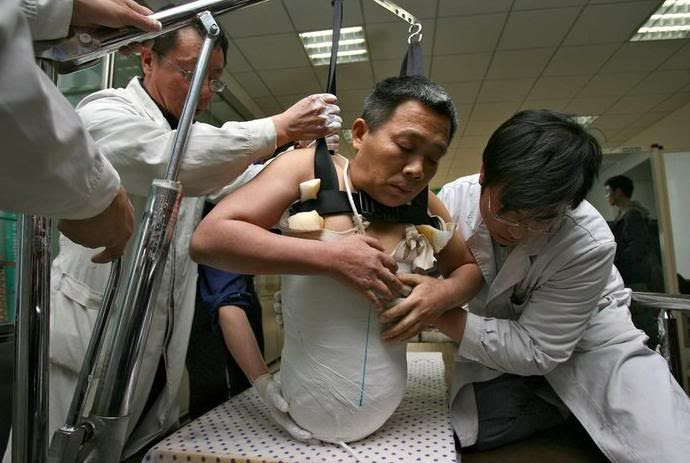 medecine et sante en Chine