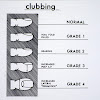 Nail Clubbing Stages / Clubbed fingers: Causes, symptoms, treatment, and when to : · the periungual skin is .