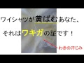 無料ダウンロード ワキガ 黄ばみ 画像 204550-ワキガ 黄ばみ 画像