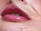 Lips