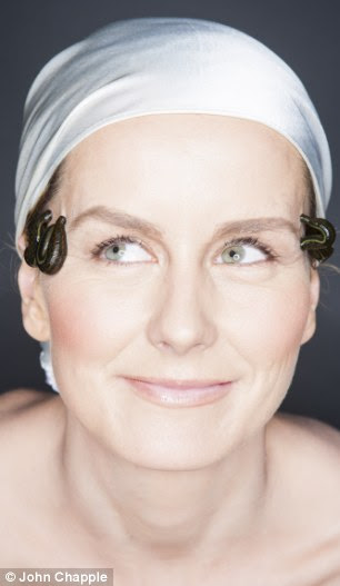 This sucks: Emma Parker Bowles tries leech therapy in the hope that it will cure her migranes