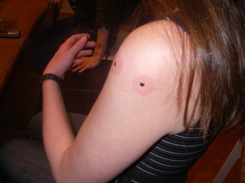 13/365 Myself and my dermal anchor cheek piercings (aka. anti-eyebrow)