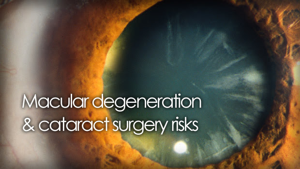 AMD patients can benefit from cataract surgery