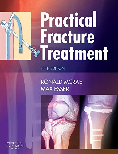 Practical Fracture Treatment, 5eBy Ronald McRae FRCS(Eng  Glas)   FChS(Hon)  AIMBI  Fellow of the British Orthopaedic Association, Max E