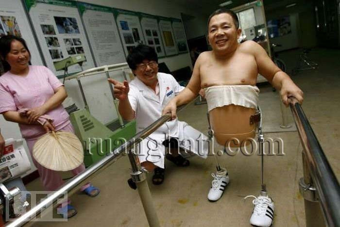 "peng yang hidup dengan separuh badan"