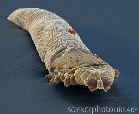 Eye mites: Millions of people have them and don't know it ...