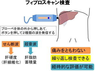 子供の脂肪肝や肝炎を簡便な検査で早期発見 肥満の子供のnash ニュース 一般社団法人 日本生活習慣病予防協会