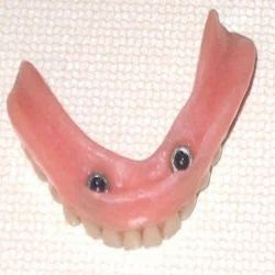 Dental Implants - Precision Dental Group : Precision