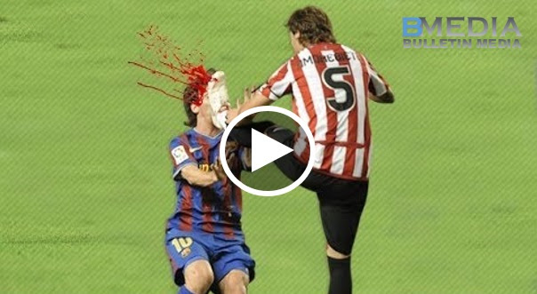 Pergaduhan Paling Brutal dan menyakitkan dalam bola sepak