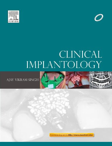 Clinical ImplantologyBy Ajay Vikram Singh