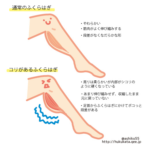 ふくらはぎのボコっとした塊の正体は こり だった ふくらはぎの塊解消クラブ