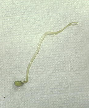 コンプリート もやし 画像 一本