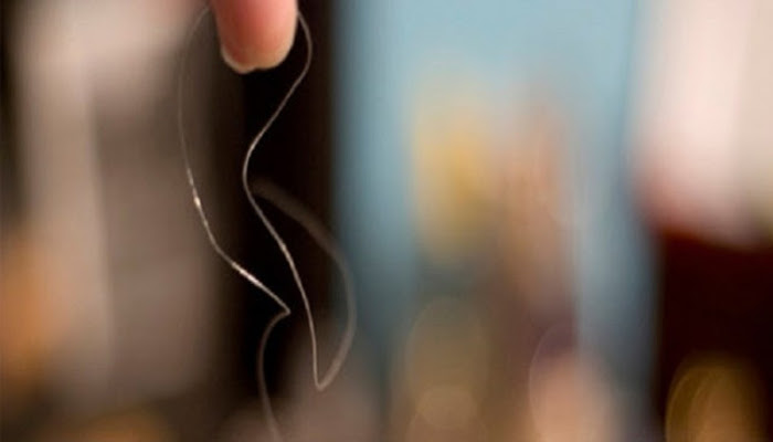 Ubanan di usia muda? Ini cara mengatasinya — Mimbar Rakyat