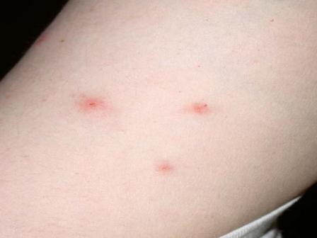 Skin Cancer Bumps On Hands - Bumps and Lumps on a Dog | ThriftyFun / The condition is easily treatable.