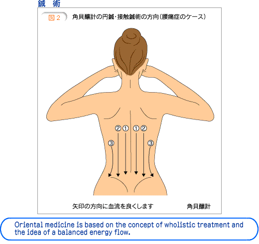 腰の痛み 腰痛 總健鍼灸治療センター 新宿 南口