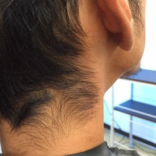 男のうなじも ヘアサロンでメンズ脱毛業