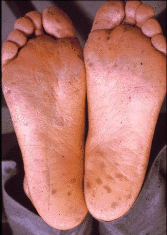 消化管医用画像データベース