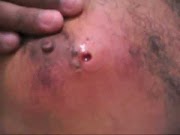 47+ Foto Bola