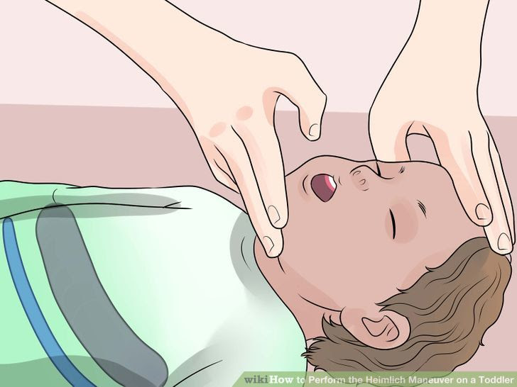 Perform the Heimlich Maneuver on a Toddler Step 14 Version 2.jpg