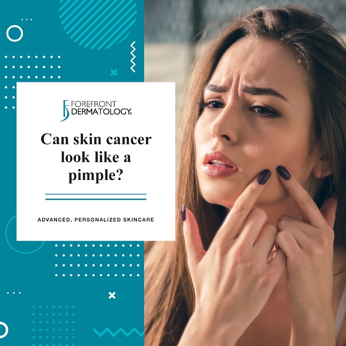Skin Cancer Detection - Skin Cancer â BASUK DERMATOLOGY