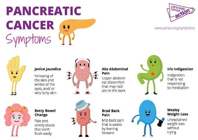 Pancreatic Cancer Stool Pictures : How To Diagnose Pancreatic Cancer 14 Steps With Pictures : The pancreas is a gland about 6 inches long that is shaped like a thin pear lying on its side.