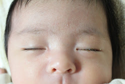画像 赤ちゃん 乳児の眼に注意 目やにの原因 Naver まとめ
