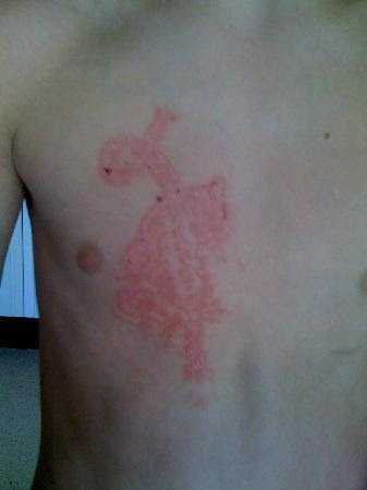 sweett. thts soo kool i wonder how long it would take to heal like until 