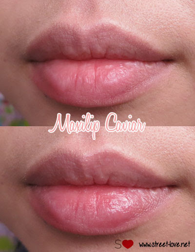 Review Lip Balm Market Leader Mentholatum Now Comes With New Variant Maxilip Anti Ageing Caviar And Lip Pure Orange Street Love